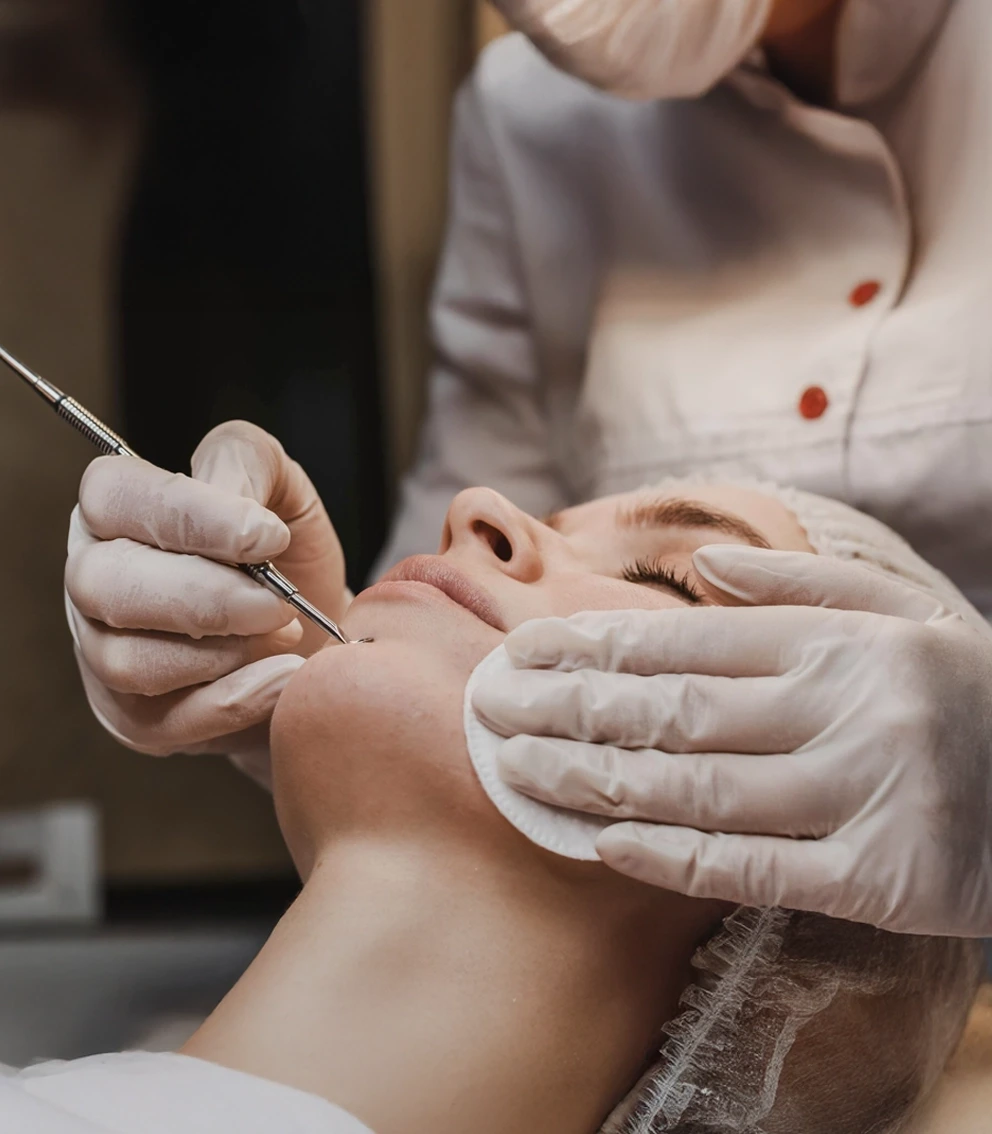 Extraction des comédons sous vapozone réalisée à l’institut La Paris’zen Institut Paris 14
